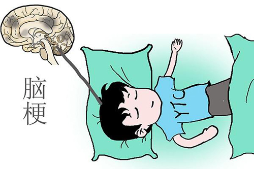 择思达斯经颅磁_脑梗是什么原因的要怎么预防好 