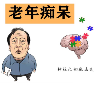 择思达斯经颅磁_老年痴呆老人要怎么照顾好呢